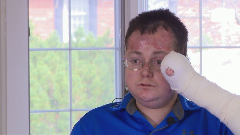 A Montgomery man born with a rare genetic disorder that leaves skin as fragile as a butterfly’s wing has helped inspire federal legislation aimed at reducing the high cost of care for families nationwide. (WKRC)